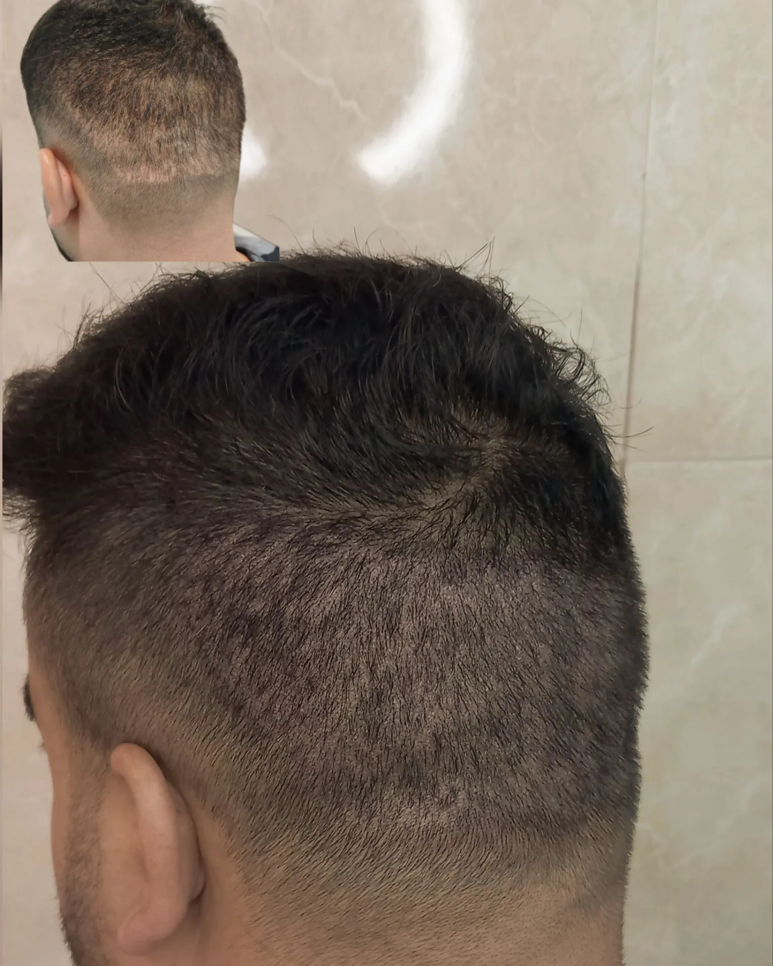 نمونه میکرواسکالپ